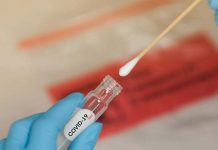 La UE no encuentra consenso para los test rápidos de coronavirus