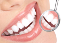 Recomendación de Expertos: ¿Cada Cuánto Tiempo es Necesaria una Profilaxis Dental?