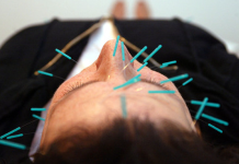 «Acupuntura y Fisioterapia: Enfoques Diferentes para el Alivio de Enfermedades y el Bienestar»