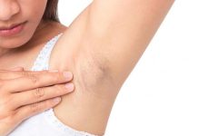 Cuidado de la Piel: ¿Por qué me salen manchas oscuras en el cuello, axilas o entrepierna, y cómo eliminarlas?