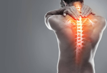 Dolor Lumbar Crónico: Cuatro Consejos para Evitar que Afecte su Funcionalidad